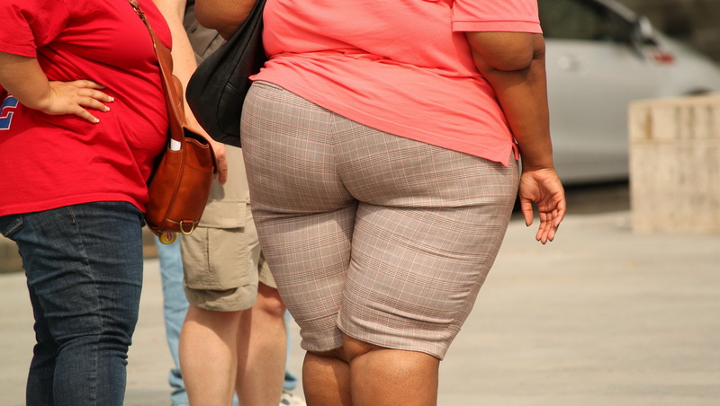 Cinco datos sobre la obesidad y el riesgo de ictus